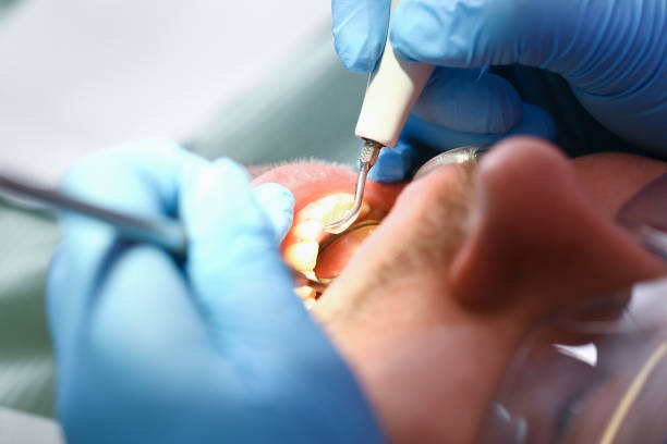 Best Broken or Chipped Tooth Repair in Dayton, WA